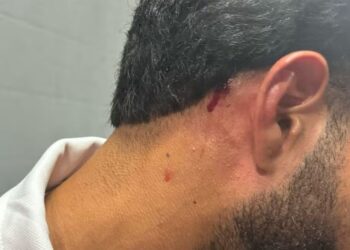 Massagista do Náutico é ferido por pedra após clássico contra o Sport