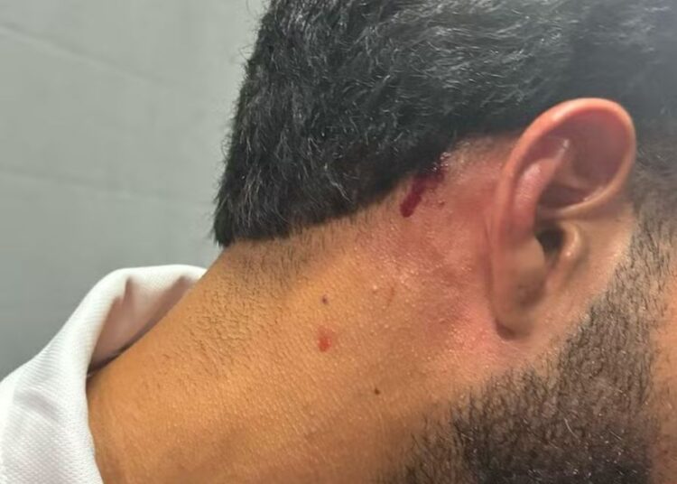 Massagista do Náutico é ferido por pedra após clássico contra o Sport